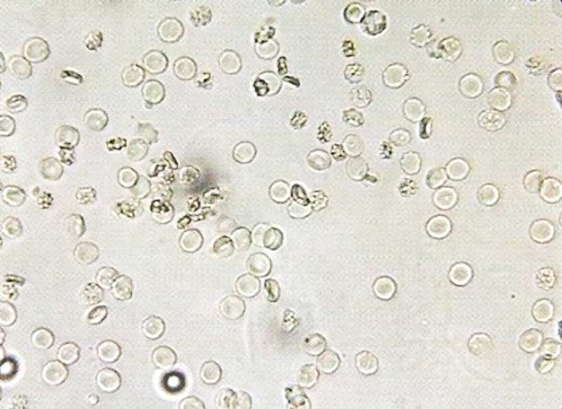 urine